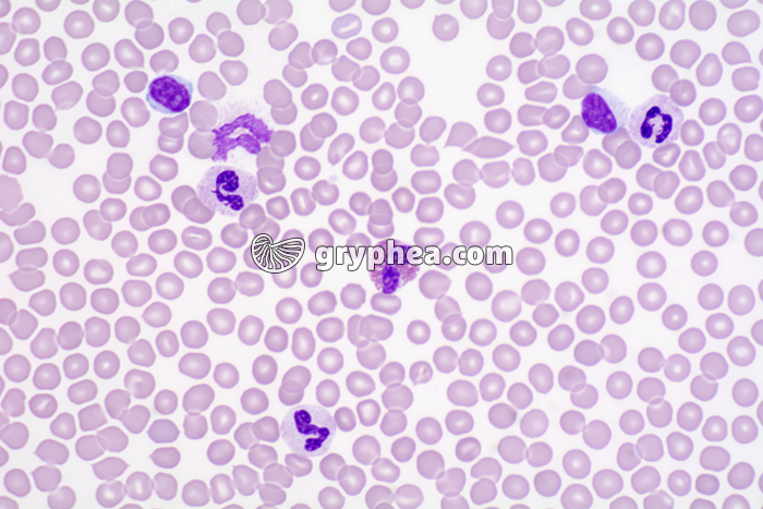 Sang humain avec leucocytes x200 - gryphea.org